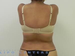 americanlipocenters_98.jpg